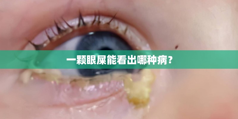 一颗眼屎能看出哪种病？