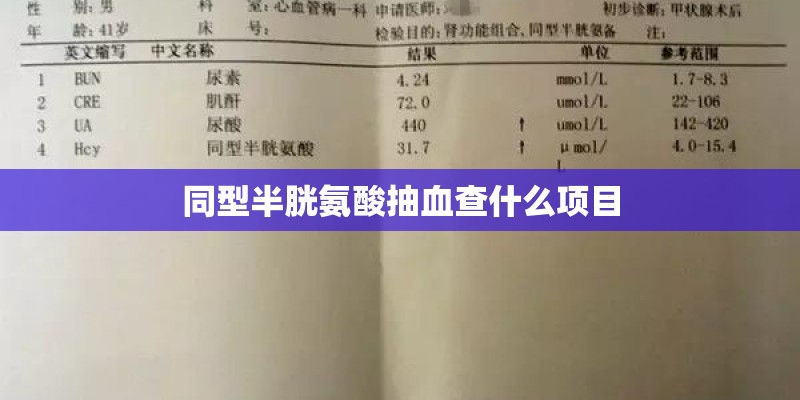 同型半胱氨酸抽血查什么项目
